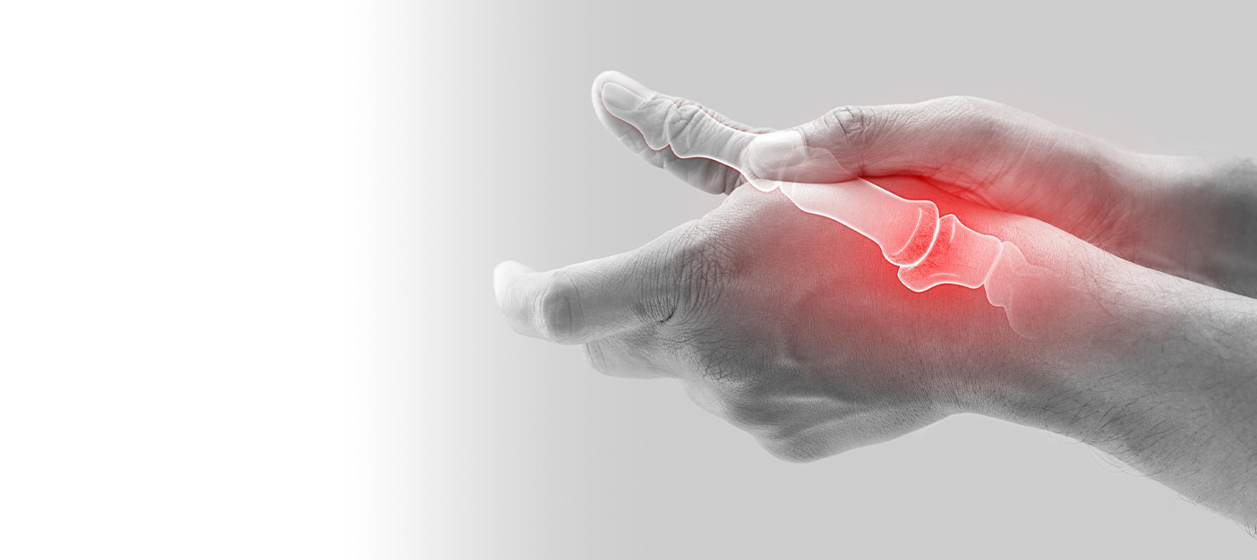 Managing Arthritis at Work: Staying Productive with Chronic Pain